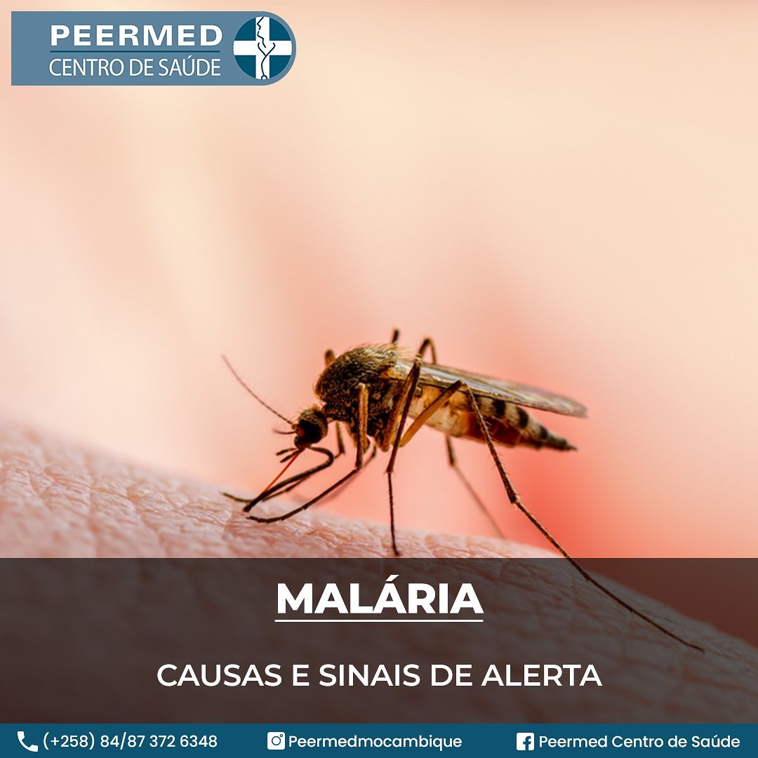 Malária: Causas e sinais de alerta